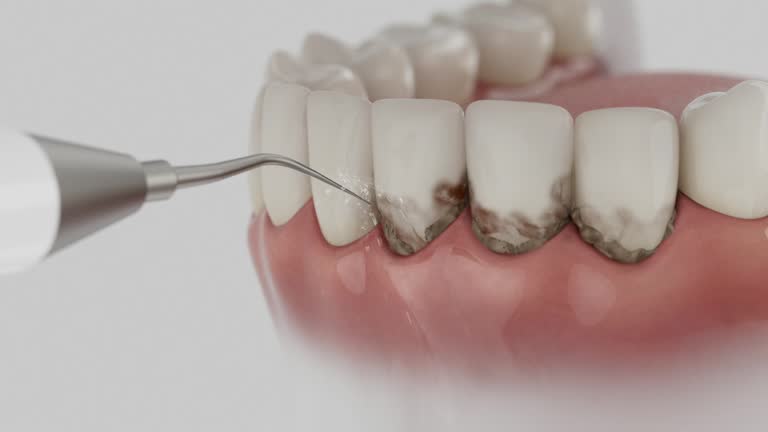 Trusted Root Canal Treatment service in Lehigh Acres, FL - Dentist Open Now